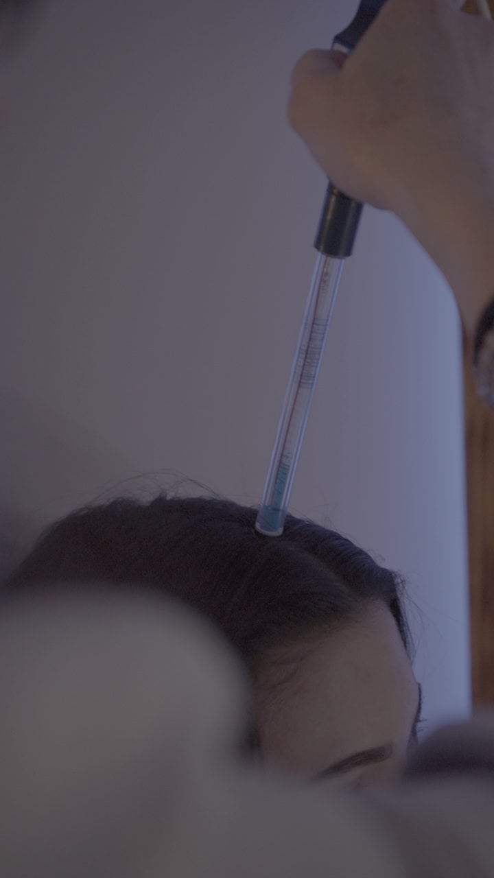 analyse cuir chevelu head spa bellarte diagnostic capillaire