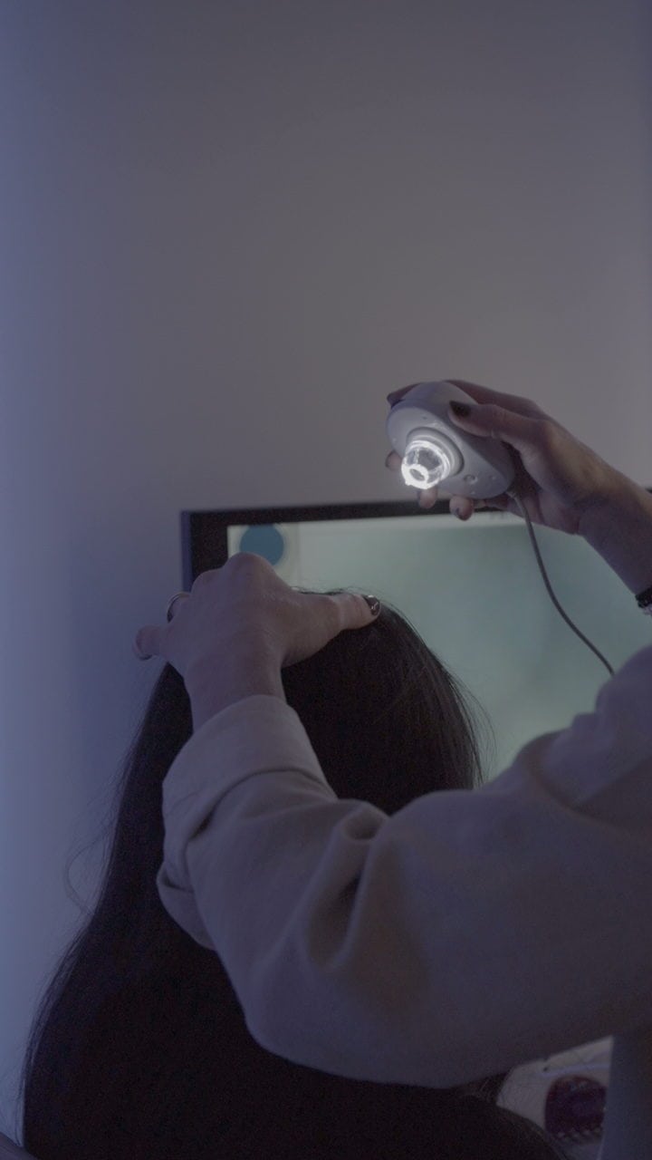 analyse cuir chevelu head spa bellarte diagnostic capillaire